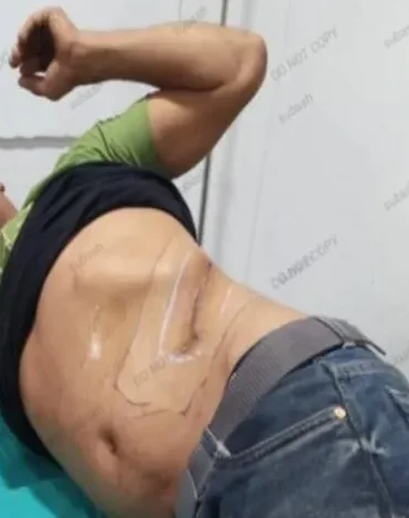 सिन्धुलीका खिलबहादुर भुजेल मानव तस्करीको शिकारमा